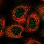 Immunofluorescent staining of human cell line A-431 shows localization to nuclear speckles & cytosol.