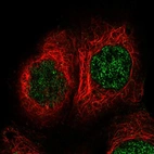 Anti-TBRG1 Antibody