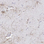 Immunohistochemical staining of human cerebral cortex shows high expression.