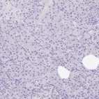 Anti-NR2E1 Antibody