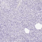Immunohistochemical staining of human pancreas shows low expression as expected.