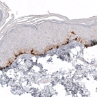 Immunohistochemical staining of human skin shows strong cytoplasmic positivity in melanocytes.