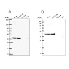 Anti-CCDC94 Antibody