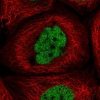 Immunofluorescent staining of human cell line A-431 shows localization to nucleoplasm.