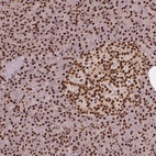 Anti-TTLL9 Antibody