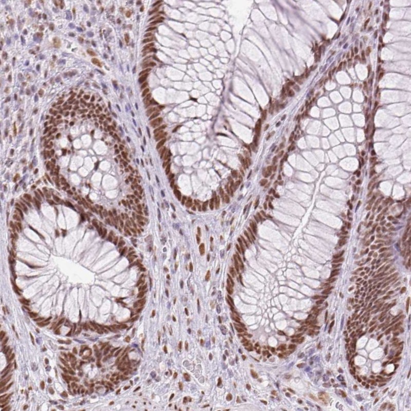 Anti-ZFR2 Antibody