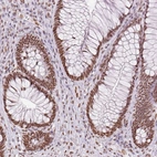 Anti-ZFR2 Antibody