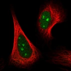 Immunofluorescent staining of human cell line U-2 OS shows localization to nucleus & nucleoli.