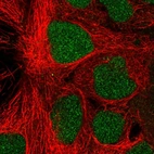 Immunofluorescent staining of human cell line CACO-2 shows localization to nucleus.