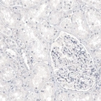 Immunohistochemical staining of human kidney shows no positivity as expected.