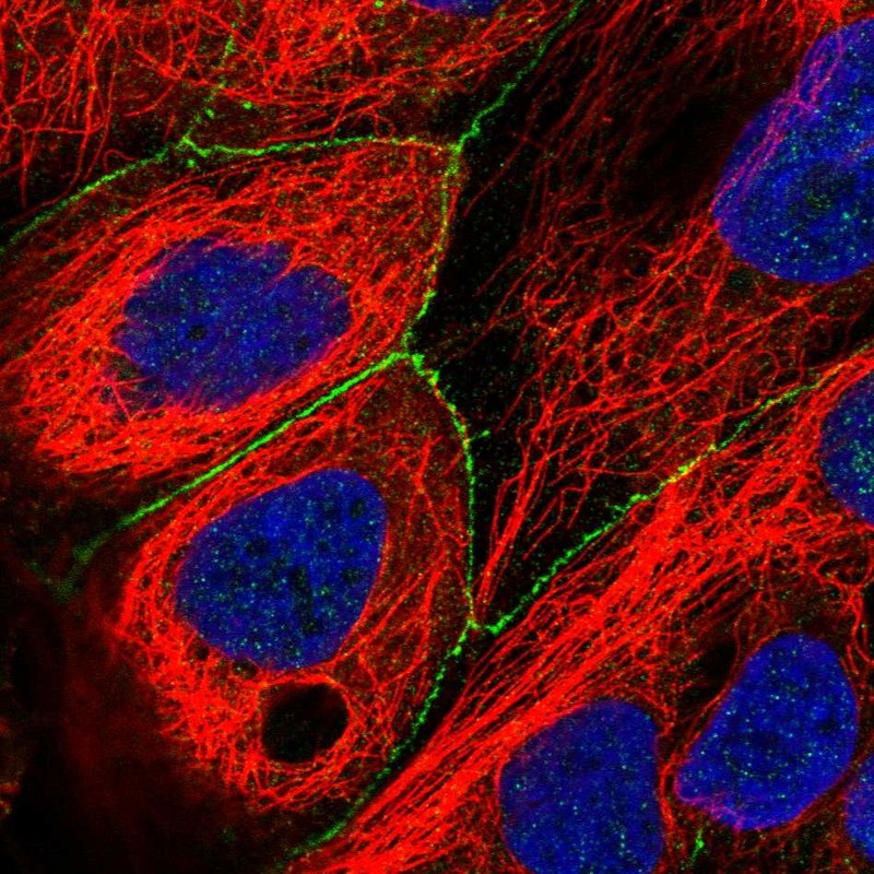 Anti-PLEKHG4 Antibody