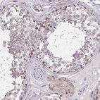 Immunohistochemical staining of human testis shows high expression.