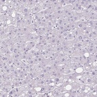 Immunohistochemical staining of human liver shows low expression as expected.