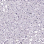 Immunohistochemical staining of human liver shows low expression as expected.