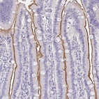 Anti-MGAM2 Antibody
