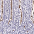 Immunohistochemical staining of human duodenum shows strong membranous positivity in glandular cells.