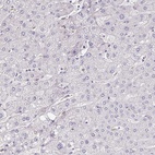 Anti-MGAM2 Antibody