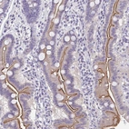 Immunohistochemical staining of human small intestine shows strong membranous positivity in glandular cells.