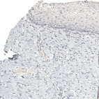 Immunohistochemical staining of human cervix shows no positivity in squamous epithelial cells as expected.