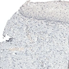 Immunohistochemical staining of human cervix shows no positivity in squamous epithelial cells as expected.