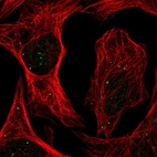 Anti-PLAGL1 Antibody