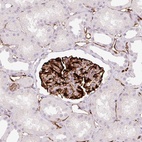 Anti-ZFYVE21 Antibody