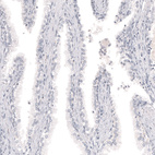 Anti-MLANA Antibody