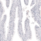 Immunohistochemical staining of human prostate shows no positivity in glandular cells as expected.