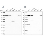 Anti-CAND1 Antibody