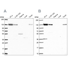 Anti-CAND1 Antibody