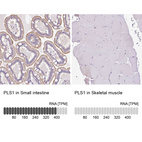 Anti-PLS1 Antibody