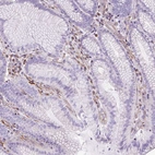 Immunohistochemical staining of human stomach shows moderate membranous-cytoplasmic positivity in lymphoid cells.