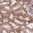Anti-MRPS5 Antibody