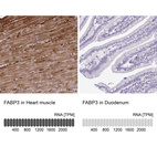 Anti-FABP3 Antibody