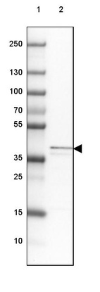 Lane 1: Marker [kDa] 250, 130, 100, 70, 55, 35, 25, 15, 10_br/_Lane 2: Human cell line RT-4