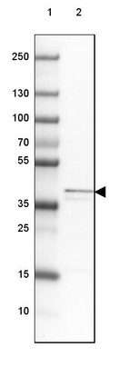 Anti-MRPS5 Antibody