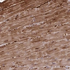Immunohistochemical staining of human heart muscle shows high expression.