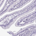 Immunohistochemical staining of human duodenum shows low expression as expected.