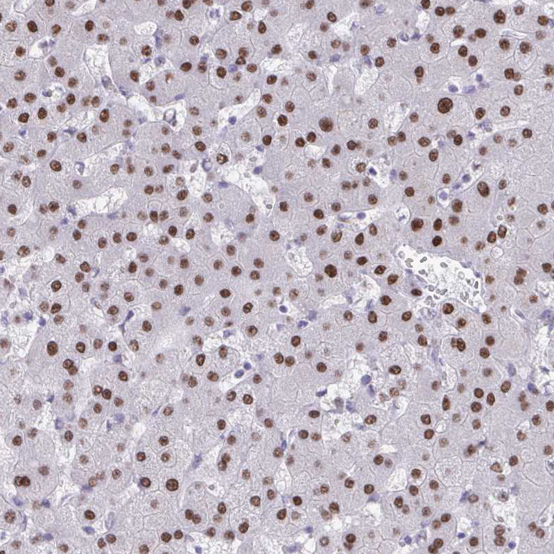 Anti-SCLY Antibody