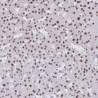 Anti-SCLY Antibody