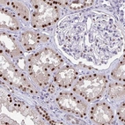 Immunohistochemical staining of human kidney shows strong nuclear positivity in cells in proximal tubules.