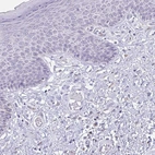 Immunohistochemical staining of human skin shows negative nuclear positivity in squamous epithelial cells as expected.