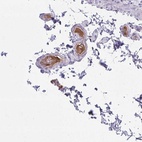 Anti-SERPIND1 Antibody