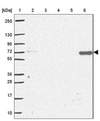 Lane 1: Marker [kDa] 250, 130, 95, 72, 55, 36, 28, 17, 10_br/_Lane 2: Human cell line RT-4_br/_Lane 3: Human cell line U-251MG sp_br/_Lane 4: Human plasma (IgG/HSA depleted)_br/_Lane 5: Human liver tissue_br/_Lane 6: Human tonsil tissue