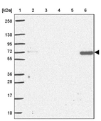 Lane 1: Marker [kDa] 250, 130, 95, 72, 55, 36, 28, 17, 10_br/_Lane 2: Human cell line RT-4_br/_Lane 3: Human cell line U-251MG sp_br/_Lane 4: Human plasma (IgG/HSA depleted)_br/_Lane 5: Human liver tissue_br/_Lane 6: Human tonsil tissue