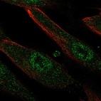 Anti-LRRC32 Antibody