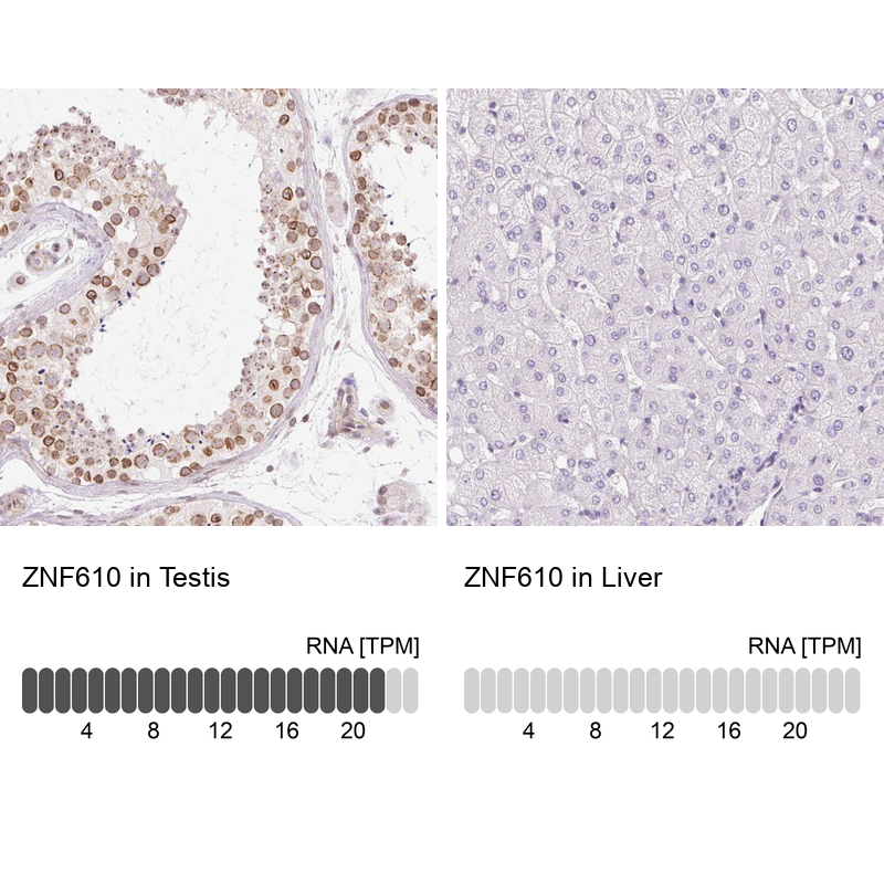 Anti-ZNF610 Antibody