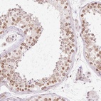 Immunohistochemical staining of human testis shows high expression.