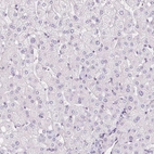 Immunohistochemical staining of human liver shows low expression as expected.