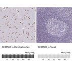 Anti-SEMA6B Antibody